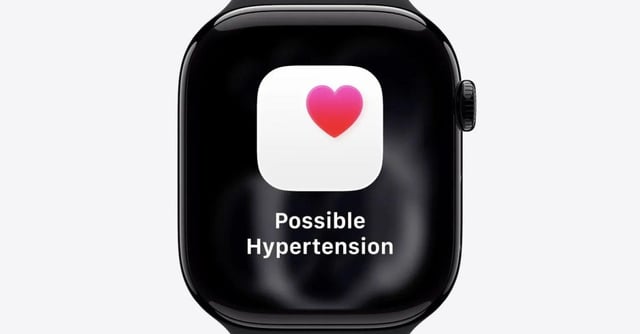 Apple Watch får FDA-godkendt funktion til hypertension – endnu et skridt mod din personlige sundhedsassistent